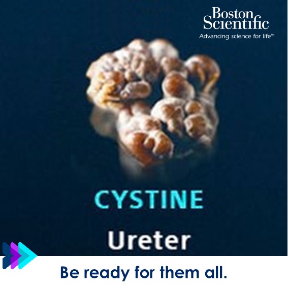 BSCEMEA_Urology's tweet photo. Do you want to provide treatment options that help patients to become stone-free as quickly and safely as possible? 

Learn more about how our extensive portfolio can support your #Endourology practice: https://t.co/DmEqzRlHMe

#BSCEMEA #AnyStone https://t.co/yCEXHo5f51