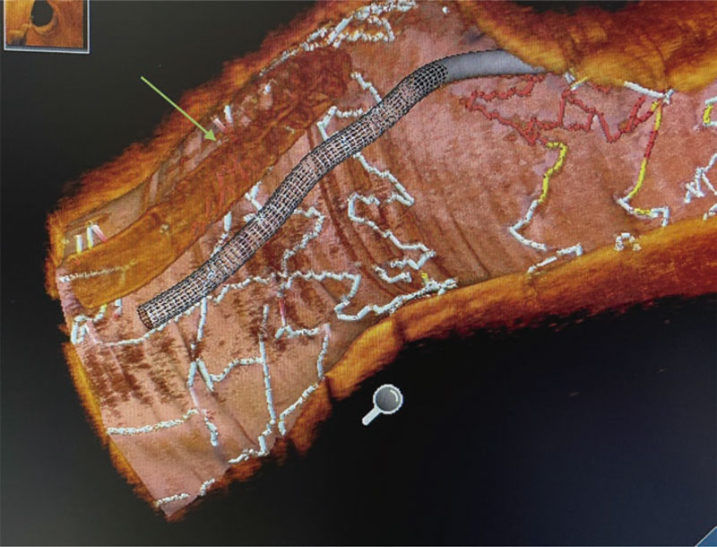 RevEspCardiol tweet picture