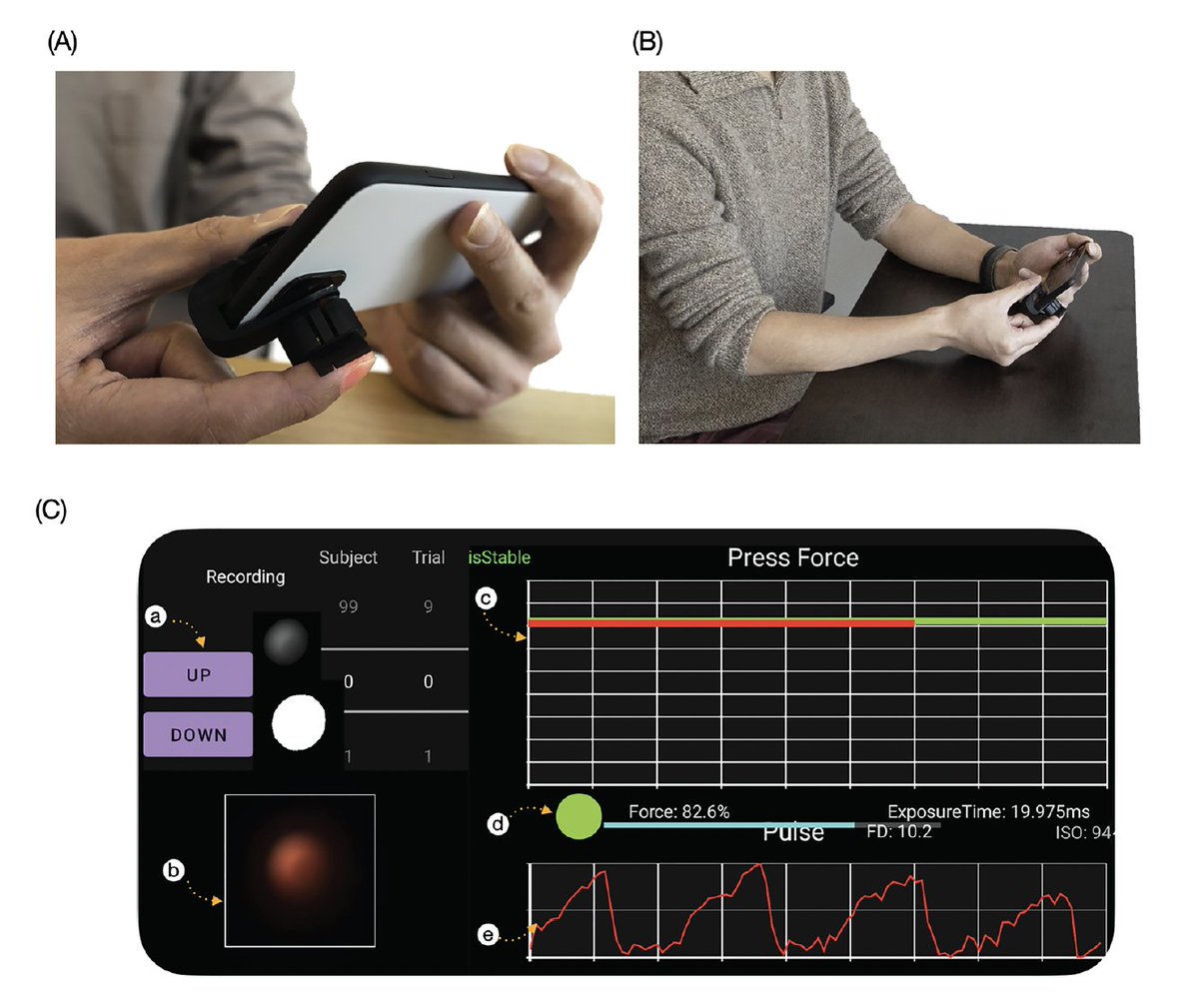 EricTopol's tweet photo. A clever smartphone attachment for about 80 cents for blood pressure measurement without need for calibration https://t.co/aMQ8tI1saM good preliminary accuracy data, needs much more assessment @UCSDJacobs @ejaywang @yinan_xuan @DesignLabUCSD https://t.co/NQfdtHTFtk