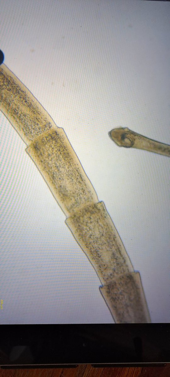 More parasites whilst working on freshwater fish for the @SANBI_FBIP #Refresh project with @TruterMarliese and @NicoJSmit1 . A beautiful cestode with its scolex and gravid proglottids visible in one frame. #parasitology #helminths #cestodes #microscopy