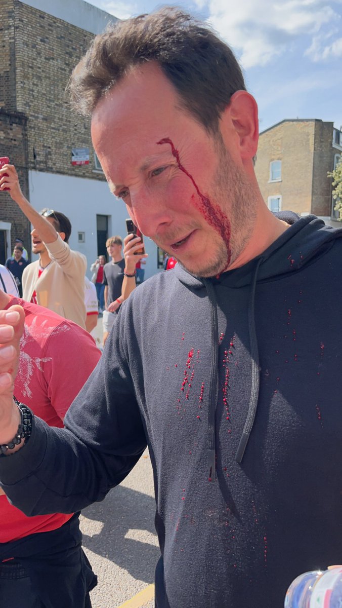 harryjemden's tweet photo. Breaking news: rob cohen get attacked by 7 wolves fans outside emirates.

True story: walked into lamppost whilst videoing the ashburton army

Never change robbo
#lampostwarrior https://t.co/d68x3f2GKT