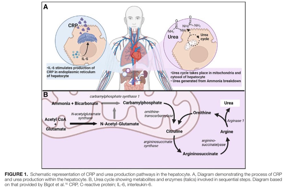 James Halle-Smith (@jameshallesmith) on Twitter photo Thank you to <a href="/TransplantJrnl/">Transplantation</a> for publishing our latest experience from <a href="/Bham_HPB_LTx/">Birmingham HPB & Liver Transplant Unit</a> which shows that:
⬇️ POD1 and POD2 CRP levels
⬇️ POD2 Urea levels
Differentiate between PNF and EAD in the first 48 hours after liver transplantation 🕒
(2/3) 🧵 Thank you to <a href="/TransplantJrnl/">Transplantation</a> for publishing our latest experience from <a href="/Bham_HPB_LTx/">Birmingham HPB & Liver Transplant Unit</a> which shows that:
⬇️ POD1 and POD2 CRP levels
⬇️ POD2 Urea levels
Differentiate between PNF and EAD in the first 48 hours after liver transplantation 🕒
(2/3) 🧵