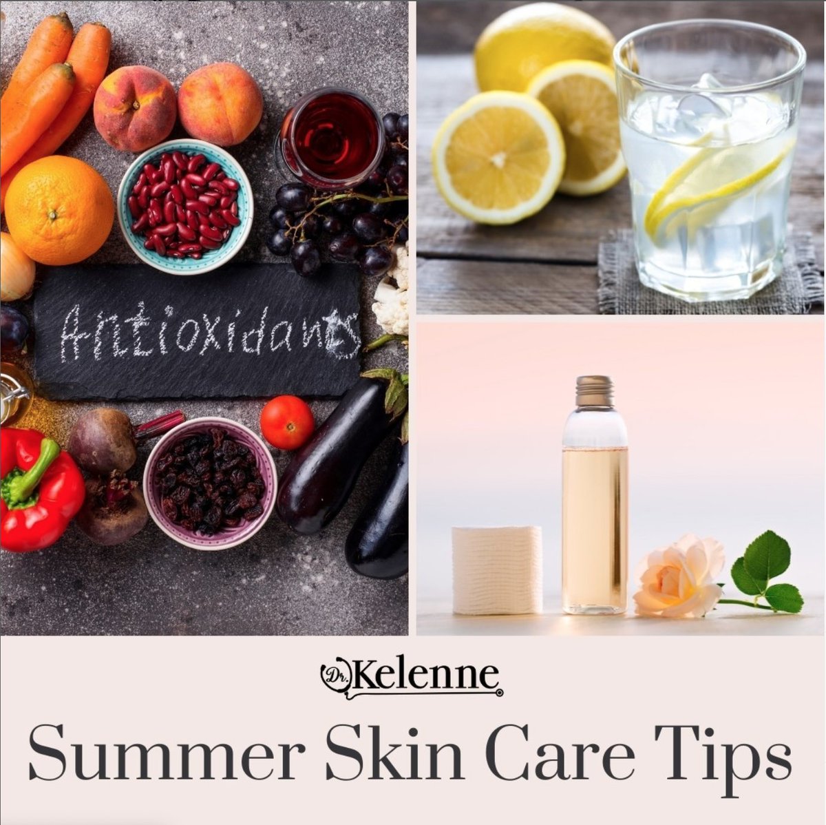Keep your skin healthy for summer! Eat more antioxidants, stay hydrated, and use a refreshing toner. #healthcaretips #familymedicine #caribbean #blackdoctor #telemedicine #telehealth #yourcaribbeandoctor #skincancerawareness 🇹🇹🇻🇨🇵🇷🇦🇬🇧🇸🇧🇧🇧🇷🇨🇦🇫🇰🇬🇩🇬🇾🇯🇲🇭🇹🇱🇨🇰🇳