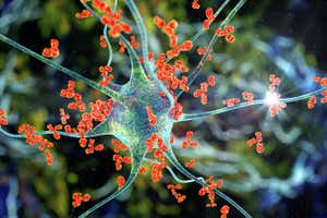 🧠 Neuralink, the brain implant company founded by Elon Musk, has received approval from the US Food and Drug Administration (FDA) for a clinical study in humans. 
buff.ly/3BYucEe 
#Neuralink #ElonMusk #brainimplant #braincomputerinterface #neuroscience #futuretech