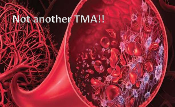 😱Challenges in medicine😱 Thrombotic microangiopathy (TMA) A short 🧵#MedTwitter 1/16