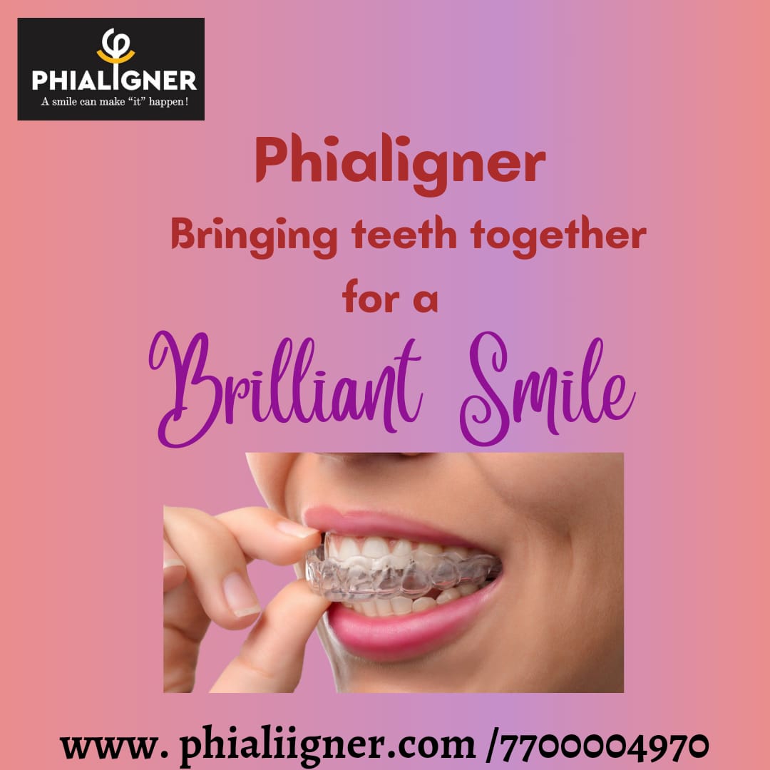 Phialigner’s bringing teeth together for a Brilliant Smile.
Aligners work by gradually moving the teeth into the correct position, resulting in a great smile.

#maintanalignerse #alignerattachment #alignercases #painless #goodsmile #smilemakeover #goodhealth #beautifulsmile