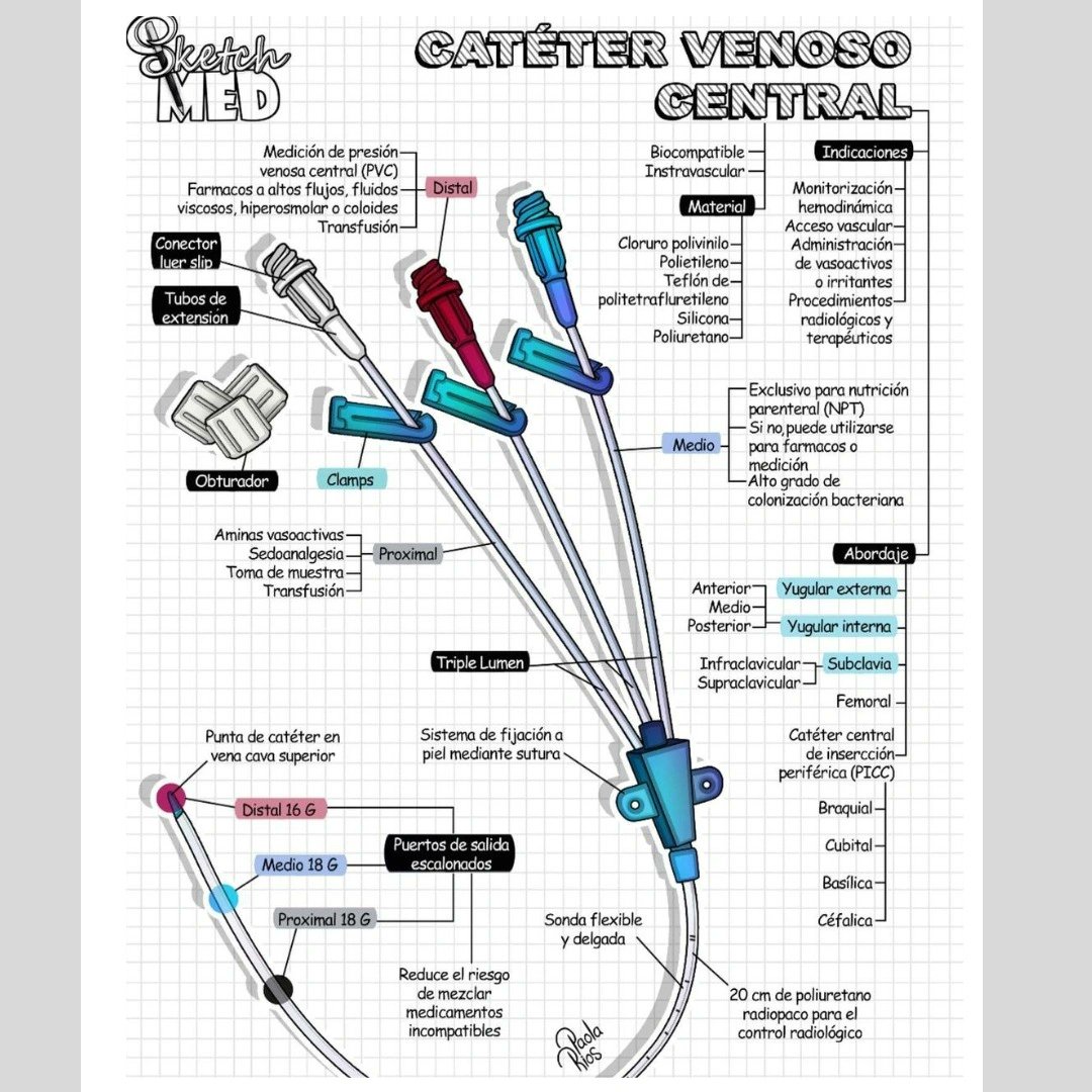 Partes del catéter venoso central
.
Infografía: <a href="/sketchmed/">عبد الضويحي</a> 
.
.
#cateter #catetervenoso #formacionsanitaria