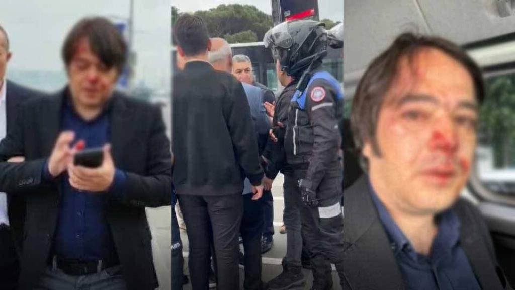 gokcebugra's tweet photo. Bunu asla kabul etmiyoruz!

Sadece resmi görevini yapmak için orada bulunan sevgili çalışma arkadaşım İBB İmar Müdürü Ramazan Gülten, kanuna aykırı kaçak yapılaşmanın sahipleri tarafından darp edildi!
Bu medeniyet dışı hareket ve öfkenin karşısında tüm kamusal ve yasal haklarımız ile durup, sürecin bizzat takipçisi olacağız.

Geçmiş olsun Ramazan.