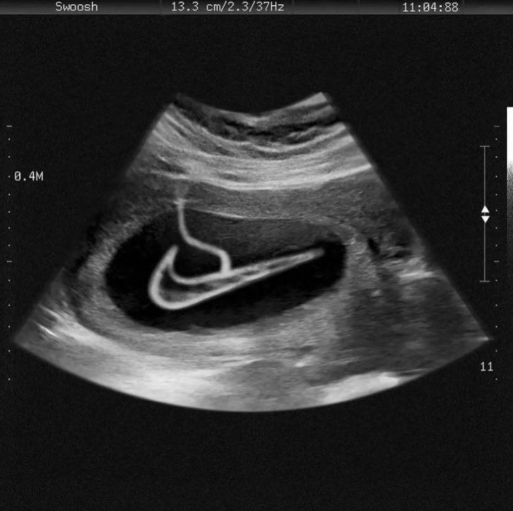 Shtreetwear's tweet image. Vintage Nike Ads