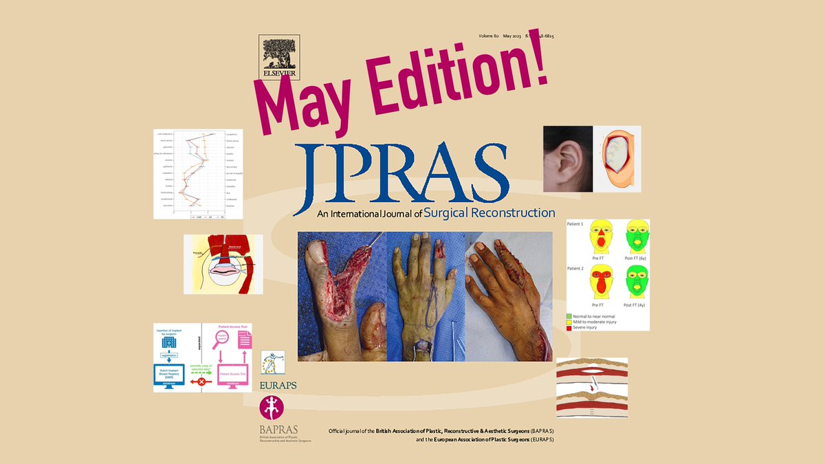 There's still time to check out the May edition of <a href="/JPRASurg/">@JPRAS</a>!

Featured on the cover: jprasurg.com/article/S1748-…

#plasticsurgery #research #evidencebasedsurgery