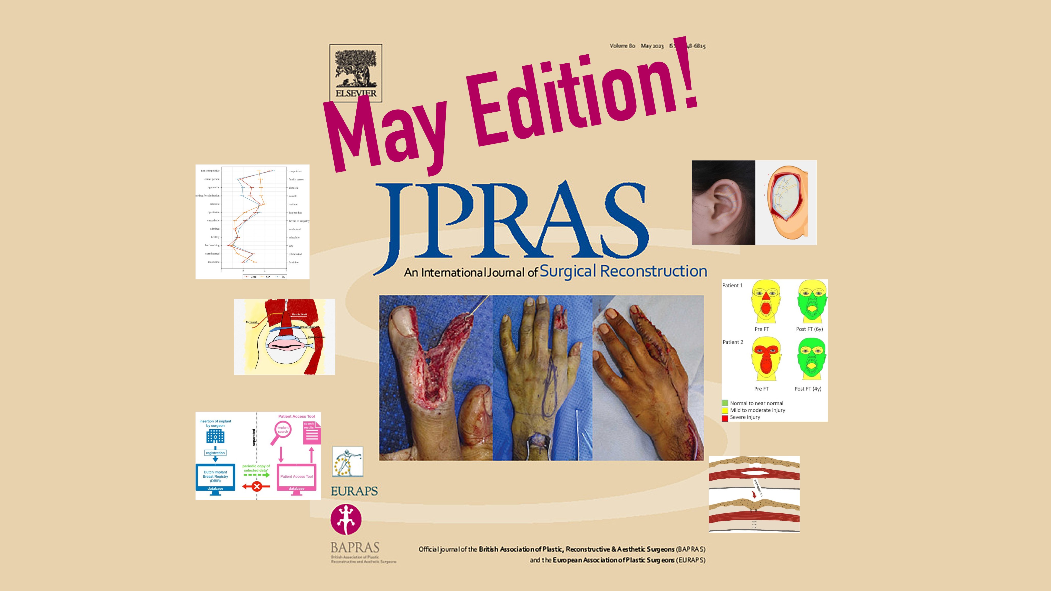 Jpras on sale