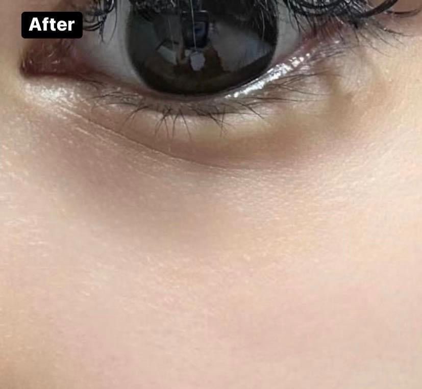 theiceraf's tweet photo. Stress tengok bintik bintik dekat bawah mata ni !! 😮‍💨😮‍💨 Dah cuba banyak jenis product &amp; kali ni cuba beli yang jenis ni sebab ada salicylic asid yang dapat bersihkan pori yang tersumbat tu 😍😍 https://t.co/S7SPIu3KVa