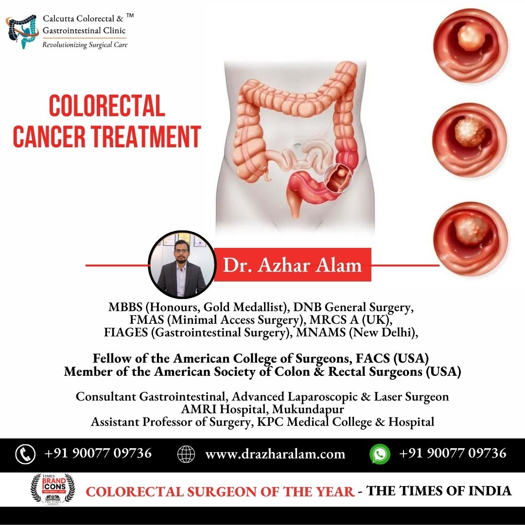 👉Call or Whatsapp: +91 9007709736
👉Website: drazharalam.com

#ColorectalCancerTreatment #StomachCancer #Hydrocele #laserclinic #lasertreatment #DrAzharAlam #AdvancedLaserTreatment #LaserSurgery #GastrointestinalSurgery #laparoscopicsurgery