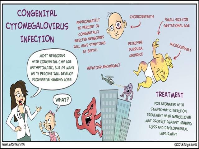<a href="/marrow_med/">Marrow</a> Congenital CMV infection Jaundice, petechiae, and hepatosplenomegaly are the most frequently noted clinical triad in symptomatic infants.