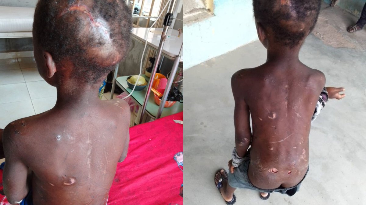 SaharaReporters's tweet photo. Nigerian Housewife Brutalises 7-Year-Old Domestic Help She Feeds Once Daily, For Failing To Clean Utensils In Adamawa | Sahara Reporters https://t.co/My0921cwgG https://t.co/wvq8ndpore