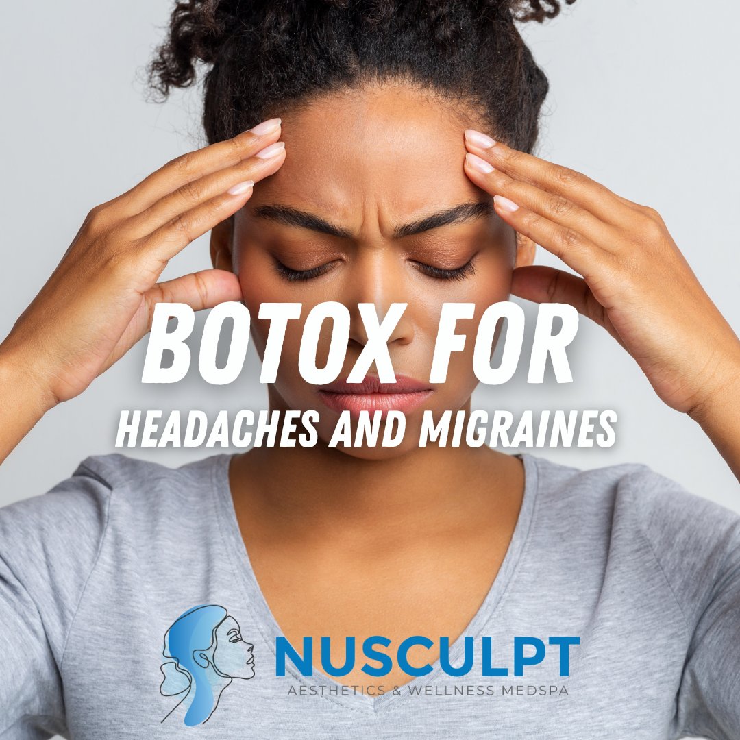 Botox can block pain signals sent from the nerves to the brain. This effectively reduces the severity of migraine headaches and can even help reduce their frequency.

Call us today or message us! 859-331-0555

#Nusculptcrestviewhills #NusculptKY #kentuckymedspa #medspa #Botox