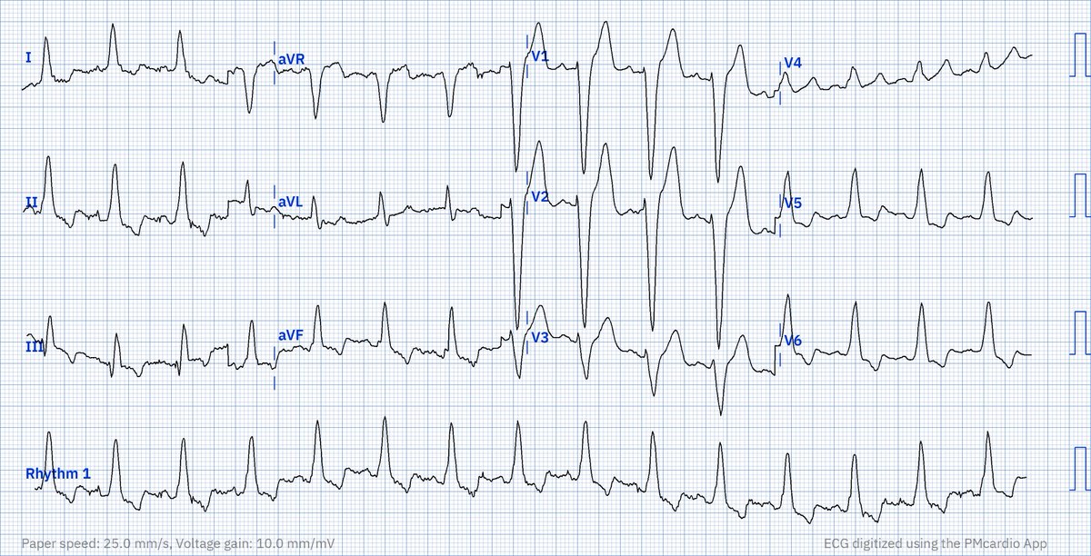 Robert Herman, MD, PhD tweet media