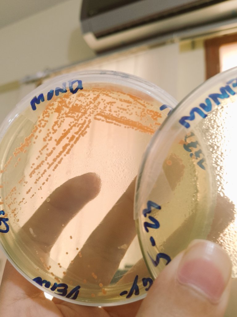 MuneefRehman's tweet photo. This bacteria (Deinococcus radiodurans) has evolved to resist butt loads of radiation but hates a little salt in it's diet. We live in a crazy beautiful world! ❤️🦠
#microbiology https://t.co/45mwuPUA5o