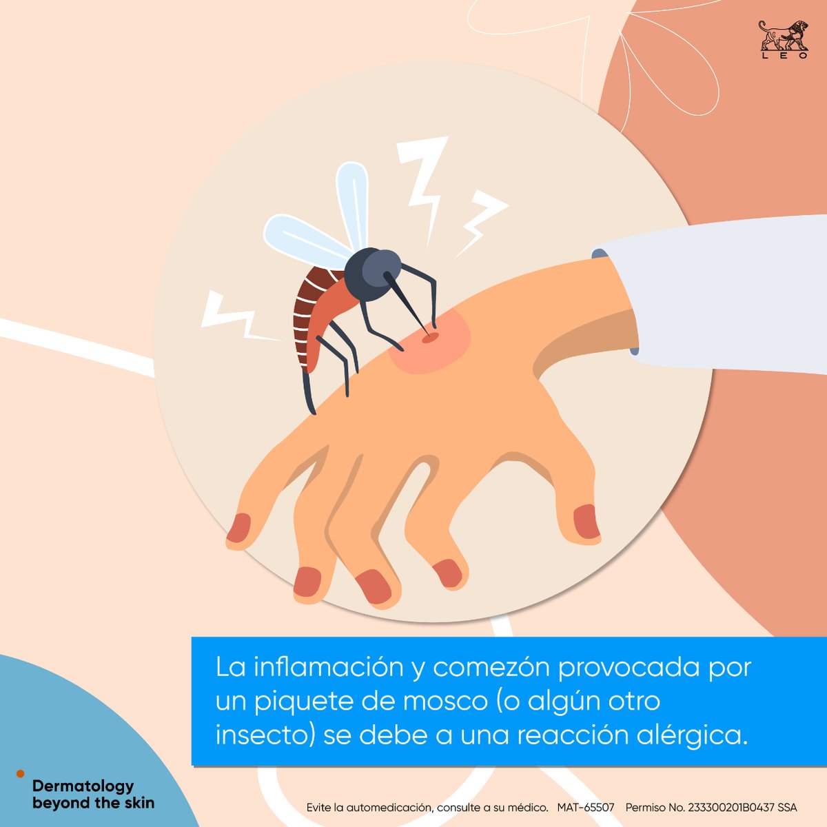 LeoPharmaMX's tweet photo. Esas molestas ronchas provocadas por los piquetes de insecto tienen un nombre: prurigo por insectos. Un especialista en dermatología puede revisarte y prescribir un tratamiento. #leopharmamx #leotips https://t.co/HO2KzRZawv