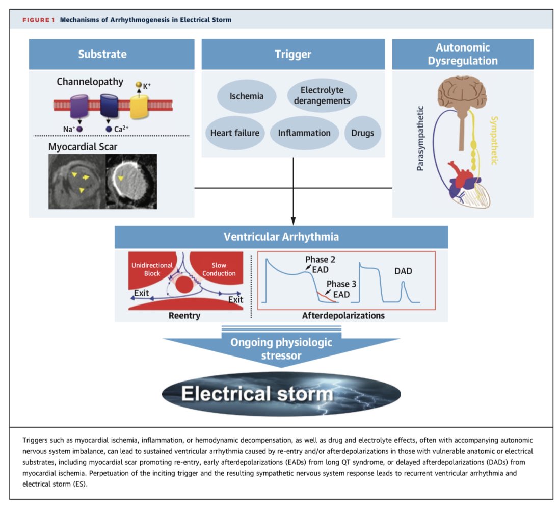 Great paper on the clinical management of the electrical storm by @ACCinTouch @JonChrispinMD 👏 @JACCJournals ➡️ jacc.org/doi/pdf/10.101… @alessia_gimelli @EZancanaroMD @EstefaniaOS @MinnowWalsh @achdoctmoe