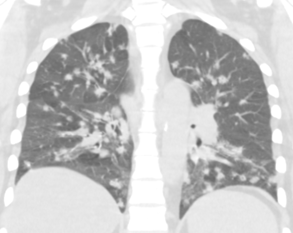 Jonathan Chung, MD tweet media
