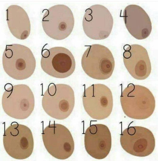 Areoles Thread https://t.co/1GhBccQS41