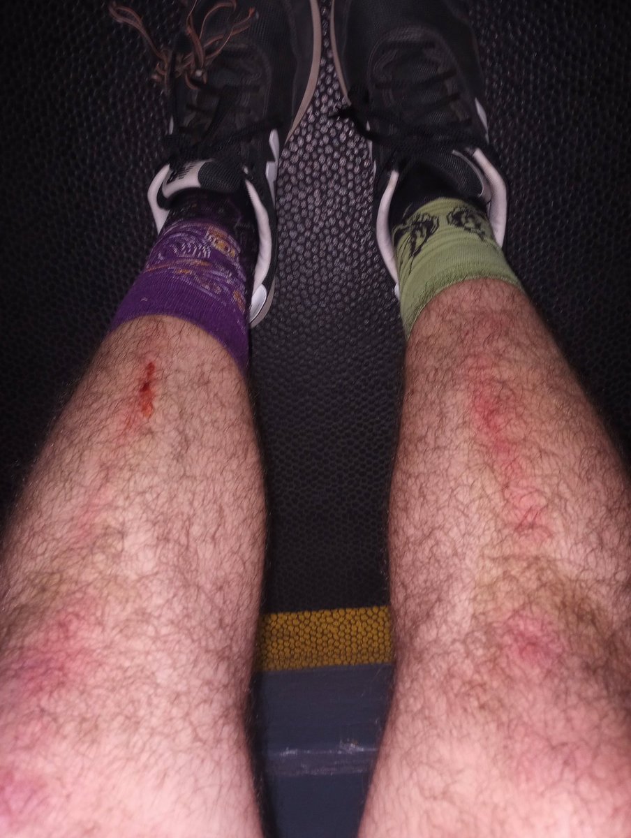 58Jayyy's tweet photo. Cleaning day aftermath. Bar to shins https://t.co/Vjoda4T5CQ