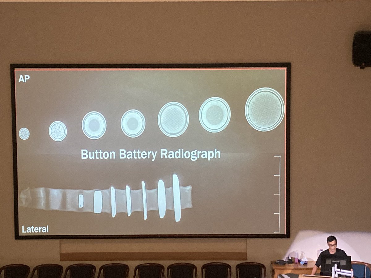 Great shot of #buttonbatteries in an xray from @drKarlitoPEMed at @westmeadkidsed Clinical update today! #paeds #foamped