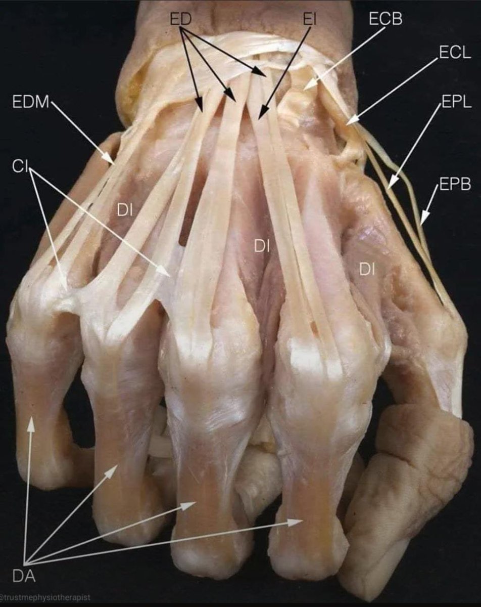 Anatomía de la mano:

ED. Extensor común de los dedos
EI. Extensor propio del índice
EDM. Extensor del 5° dedo
ECB. Extensor radial corto del carpo
ECL. Extensor radial largo del carpo
DI. Interóseos dorsales
EPB. Extensor corto del pulgar
EPL. Extensor largo del pulgar