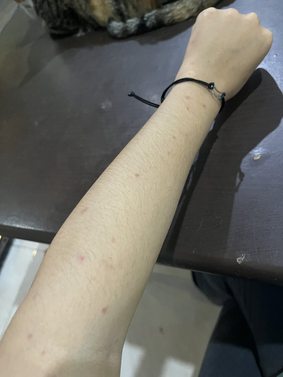 riyanirid's tweet photo. Nyamuk❤️‍🔥golda O itu nyata adanya🥹😢 https://t.co/RSlreAg3VC