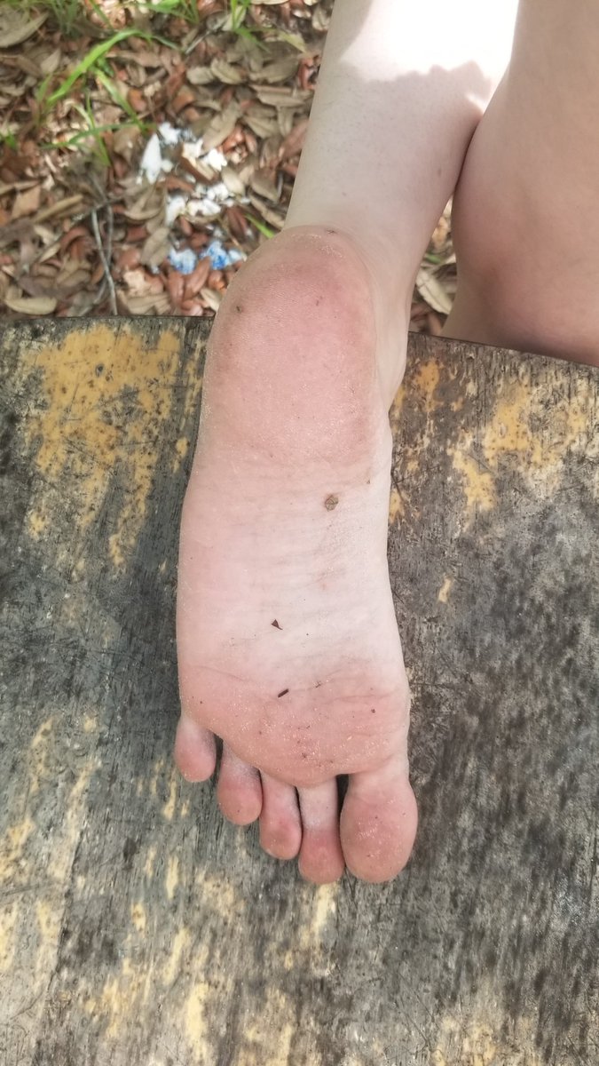 Soles2Southern's tweet photo. Make sure you come say hi and enjoy some awesome content 😘
https://t.co/ofLnARxvvJ

#feetcontent #feet #feet_lover #feetpicsforsales #onlyfans #onlyfansgirl #onlyfansbabe #onlyfans_girl #subscribe #SubscribeToday #SubscibeHere #only$5 #sole https://t.co/vCKlpoxv9d
