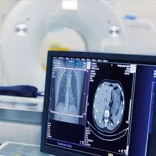 AIPINTL's tweet photo. Did you know that pet imaging can help diagnose and monitor multiple sclerosis? it can show changes in the brain and spinal cord, helping doctors track the progression of MS. Plus, our furry friends can even benefit from pet imaging too #healthcare 
https://t.co/GKnhGllZpK https://t.co/Zi1NmYvlBN