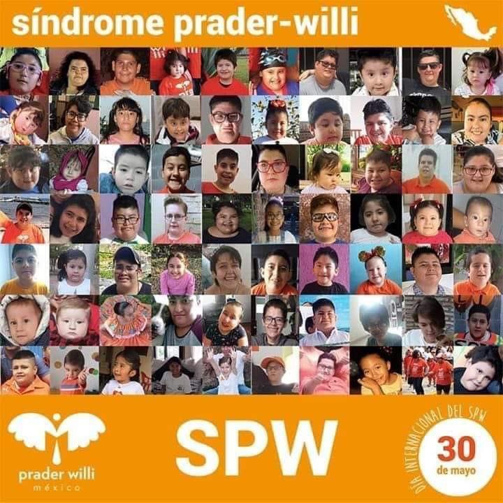 Solo más de 250 familias Prader Willi en la Fundación María José @praderwilli_fmj 
#SPWMX