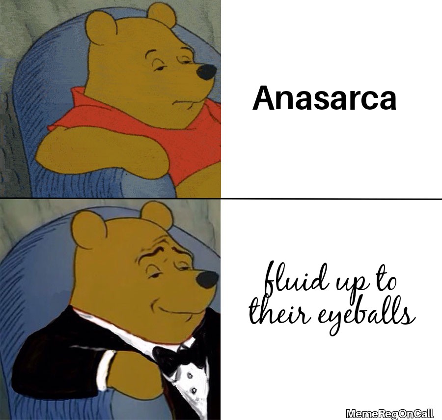 MemeDocOnCall's tweet photo. #MemeReg #MedicalMemes #MedTwitter #MedMemes #Anasarca #BigWords #SoSmart #WaterTablets #WinnieThePoohMemes #PoohMemes https://t.co/E32pBfQmEx