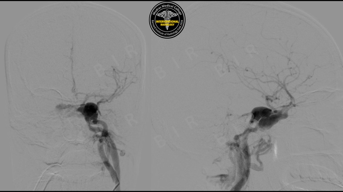 Interventional Radiology BIR, RGGGH@Chennai tweet media