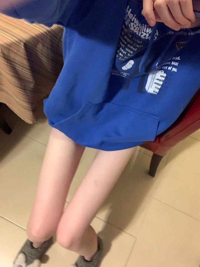pisscarcomrade's tweet photo. ˚₊‧ ୨ a thread pf my fav thinspo
🐾☆ https://t.co/sIHgI9Hioi