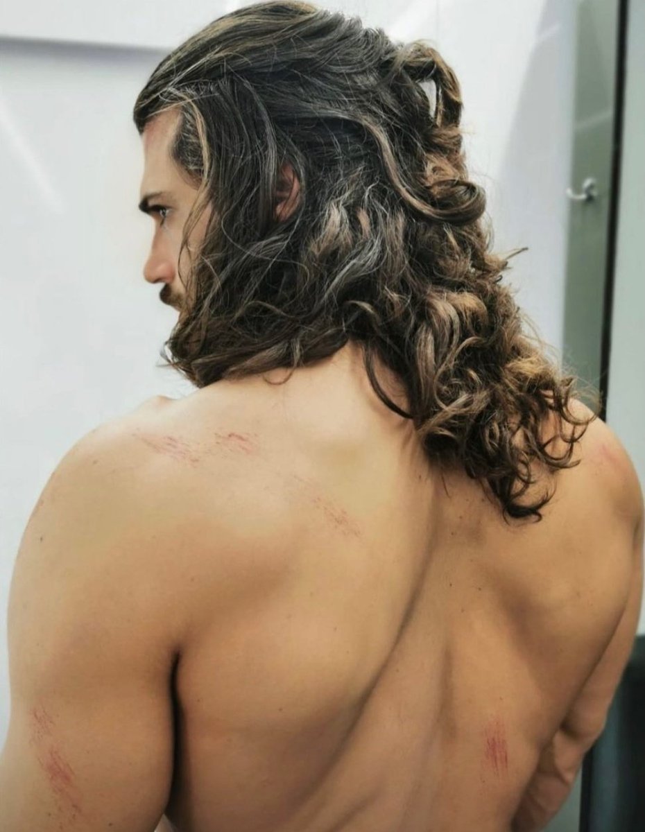 #CanYaman'ın çekimleri İtalya'da gerçekleşen dizisinin dövüş sahnelerinde sırtında çizikler oluştu.