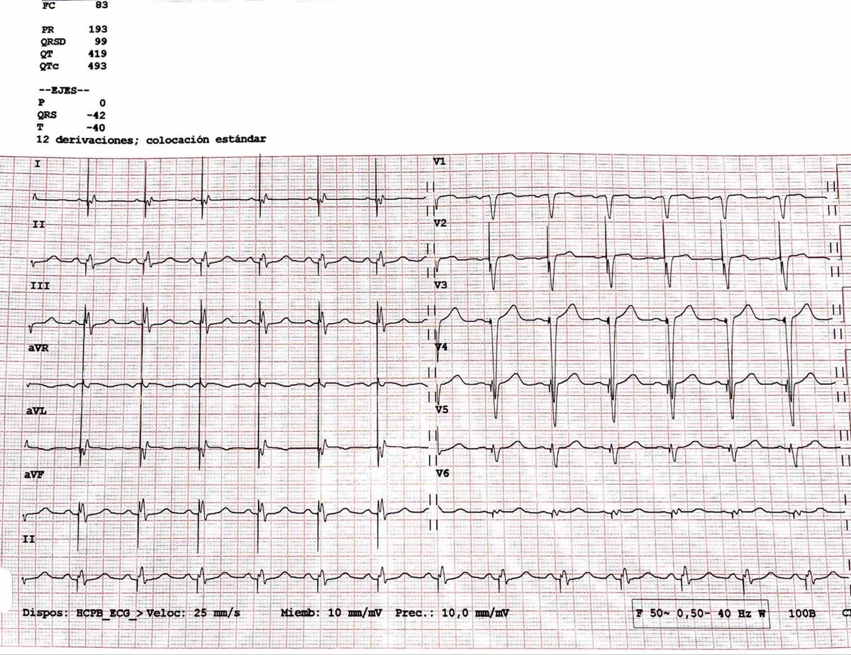 Pask_27's tweet photo. Seems that CRT won’t die 😁 #EPeeps #CRT #resync #QRS @tolosanaviu @MargaridaPujol @LluisMont2 https://t.co/oGRHGVZ046