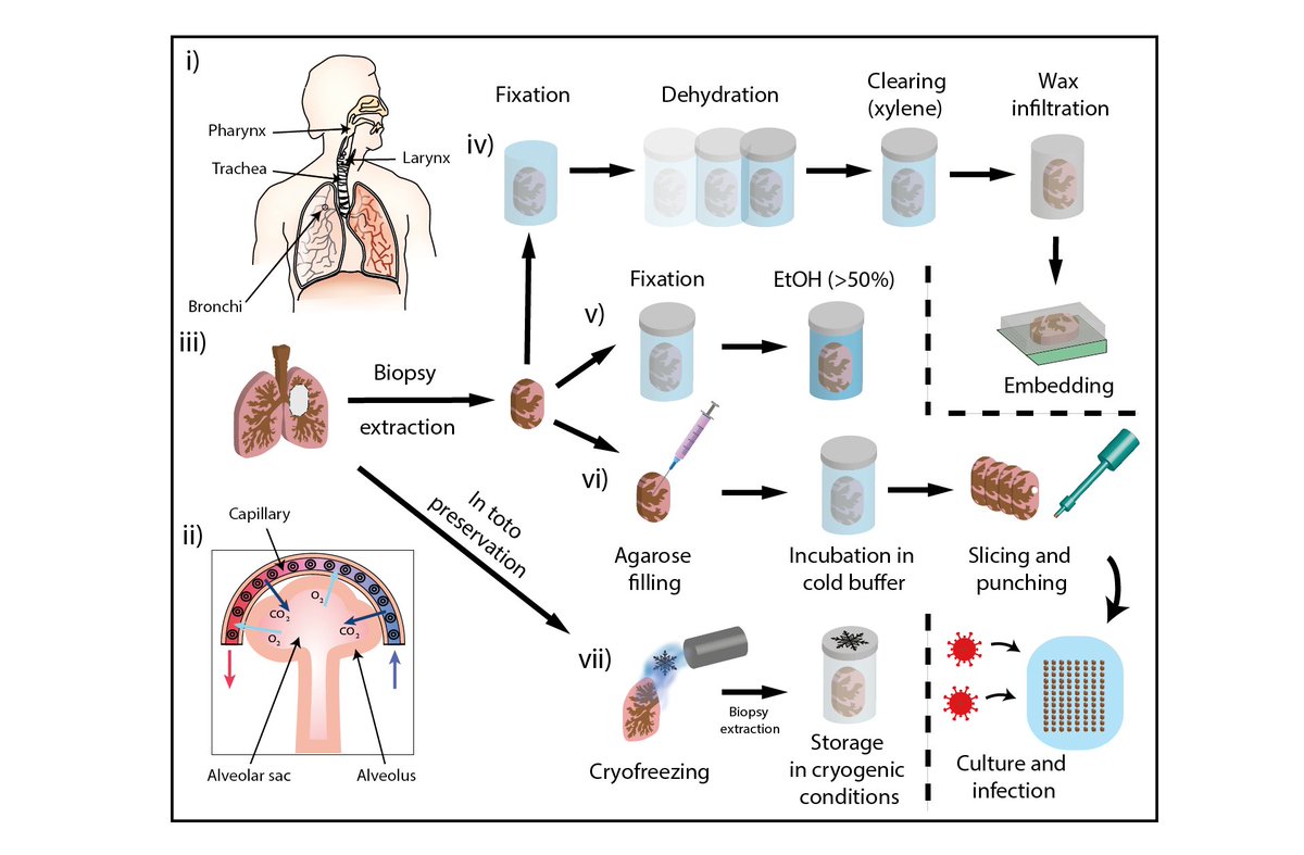 The lung, with its intricate networks of ventilation and vasculature, is an ideal example of how #3D structure enables organ function!  In our latest publication, we explore human lung tissue by #XPCT to study pathological abnormalities at various scales:  iopscience.iop.org/article/10.108…