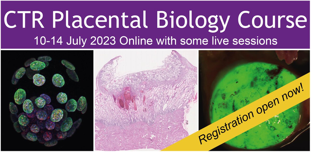 📢Registration is now live for the Placental Biology Course 2023! Limited places so book early to avoid disappointment. An interactive mix of on demand lectures and live sessions with leading lecturers. trophoblast.cam.ac.uk/placentalbiolo…