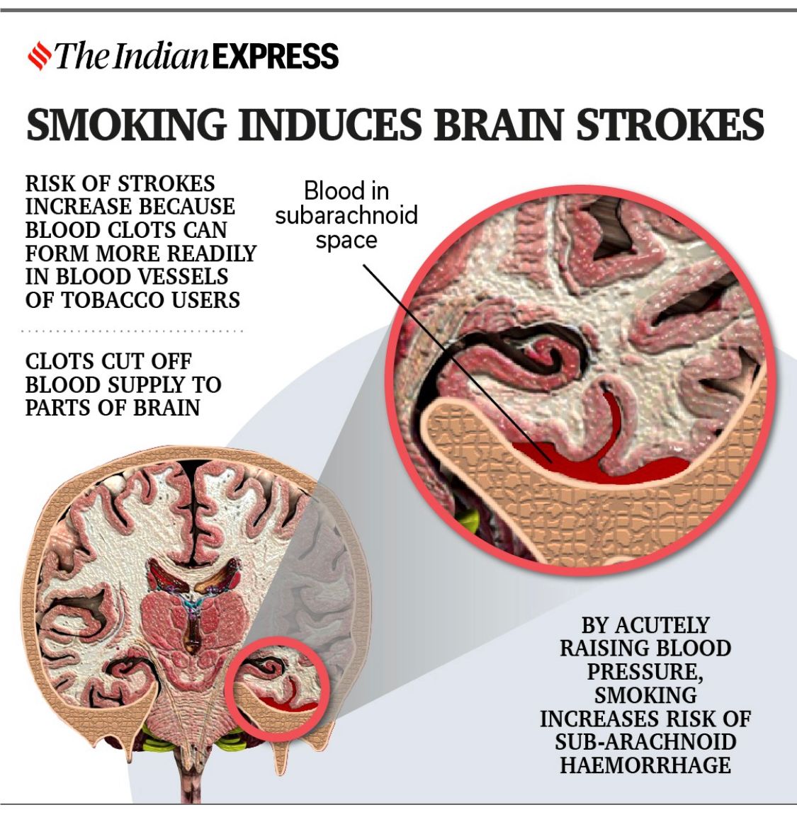 IndianExpress's tweet image. #Replug | #WorldNoTobaccoDay2023: 🚬🚫

♦️ Tobacco use promotes both atherosclerosis (fat deposition coupled with fibrosis) in the vessel walls and thrombosis (blood clot formation) on the damaged vessel walls. 

♦️ Composition and levels of blood fats are affected by smoking.