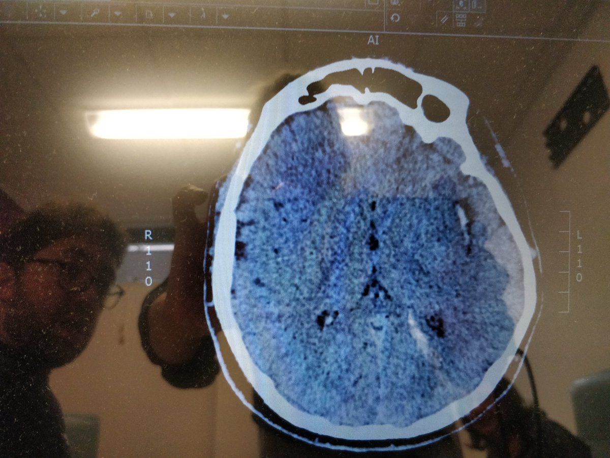 Owen Walker tweet media