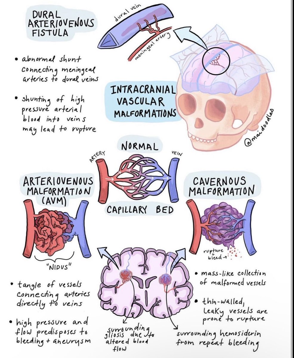 Nice overview of brain vascular malformations.

Credits: Mai Stewart

#MedTwitter