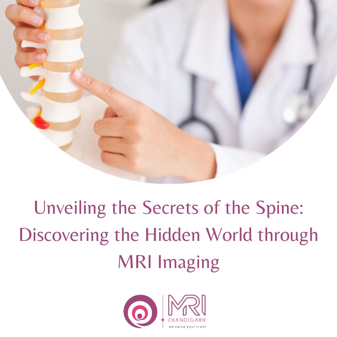 MRIChandigarh's tweet image. From diagnosing spinal conditions to assessing disc degeneration and spinal cord compression, MRI provides invaluable insights for better treatment planning. 
#SpineMRI #SpineImaging #MRItechnology #MedicalImaging #MRIInsights #SpineCare #SpineDiagnosis