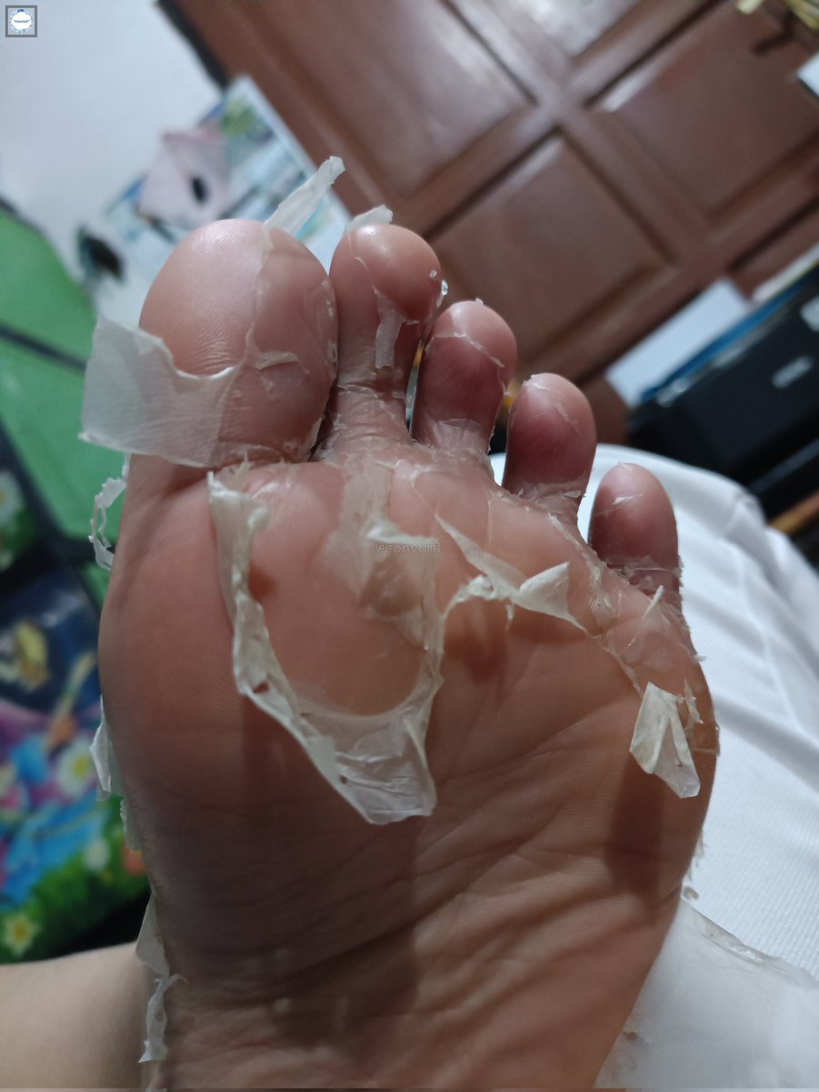 Tw // skin, dryskin, foot

Pake footmask lagi fase ganti kulit, pengen kopekin kalau lagi ngelamun gini 😭 💙