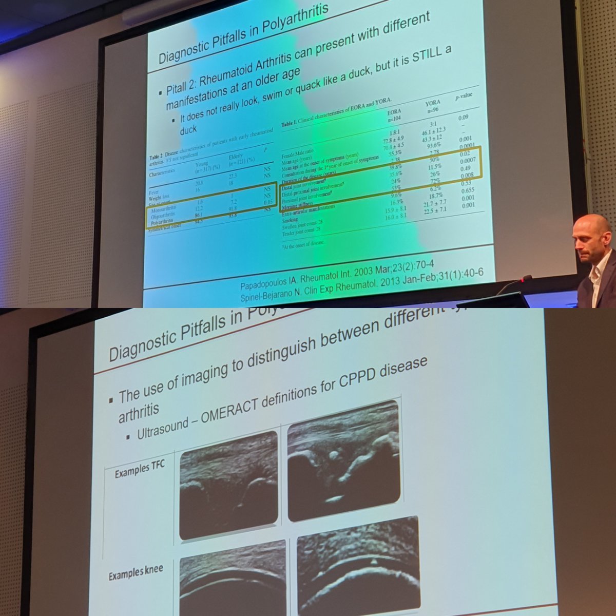 eular_ARD's tweet photo. Arthritis may present differently in oder age
#EULAR2022
Look from different angles:
- Use imaging
Both US and xray
- antibodies: ie. Rheumatoid factor levels have a langer spread
- take time for history taking acknowledge impairments that elderly might have https://t.co/14W4YDrrAS