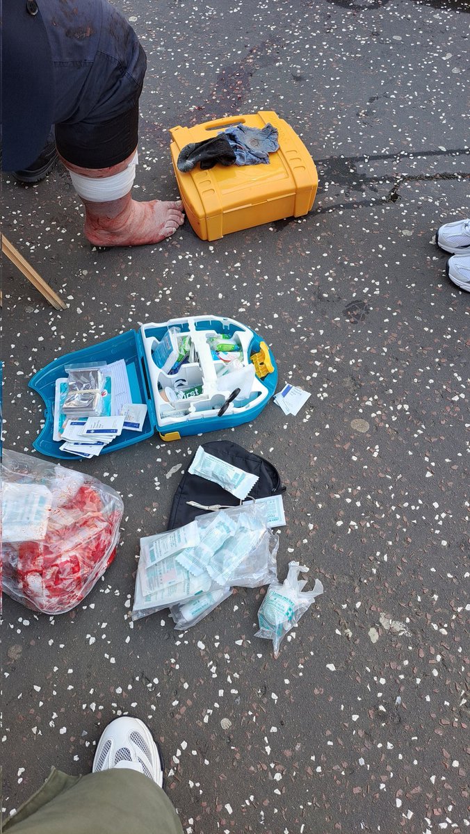 Dr_Gavin_Brewis's tweet photo. Walking along to meet @court_moffat some guy sitting losing a lot of blood with his leg smashed in. I stop to help and C jumps out the car with hazards on. Give the guy first aid before prepping him for hospital. Walk to the car and we've got a parking ticket. F#cking typical! https://t.co/G2DqC7Kpzm