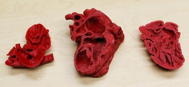CHUFOfficial's tweet image. Chuf has funded 3D heart models since 2015, costing £59,000.

Printing 3D models for patients with complex congenital heart disease means they can be used to plan the surgical approach in patients with the most complex congenital heart diseases.😮

#cryptodonation #crypto