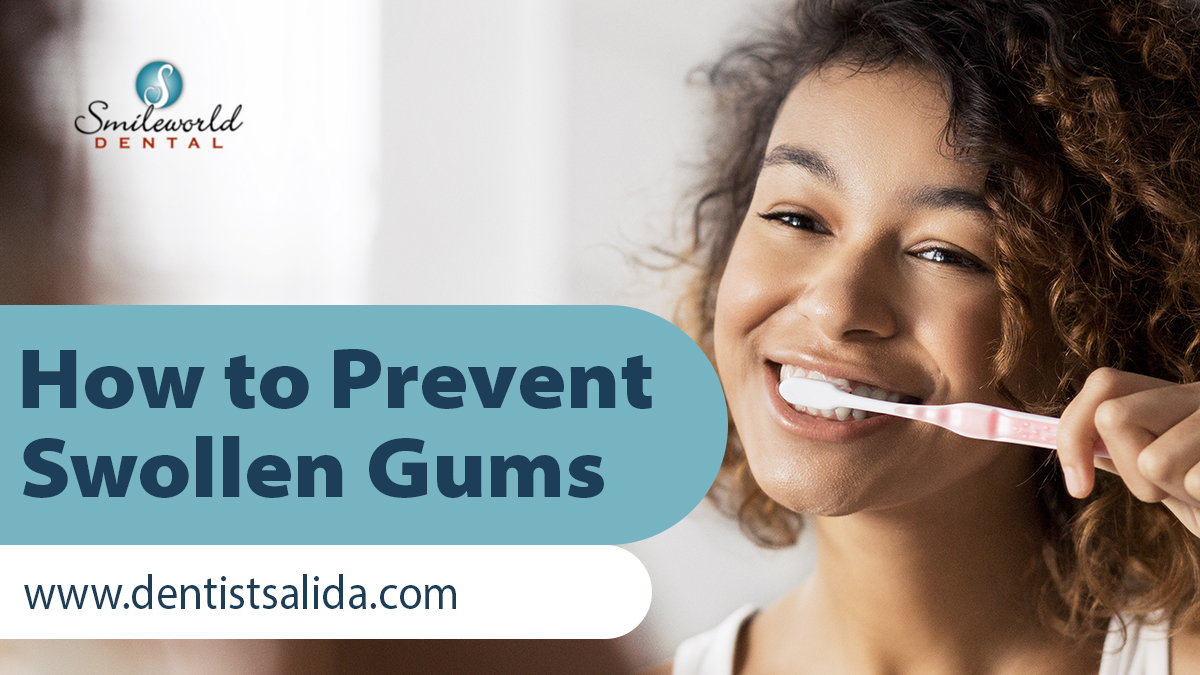 🌟 Practice good oral hygiene by Brushing at least twice a day, Clean between your teeth with floss. And be sure to see your dental professional for regular appointments. Say goodbye to swollen gums for good! 😁 Call us at (209) 354-3571
  #OralHealth #HealthyGums