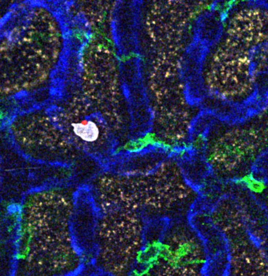 A new #NIAID study helps explain why drugs that suppress C5, a protein in the complement system, put people at risk of deadly #fungal infections. These findings show C5 plays a key role in antifungal immunity. Read more in @cellpressnews: doi.org/10.1016/j.cell…
#immunology
